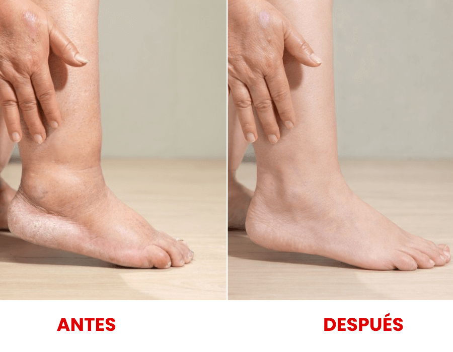 BEE FIT – Alivia el Dolor en Segundos y Repara tus Articulaciones