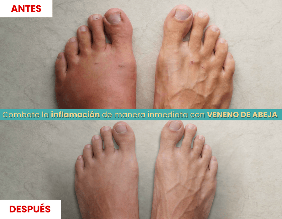 BEE FIT – Alivia el Dolor en Segundos y Repara tus Articulaciones