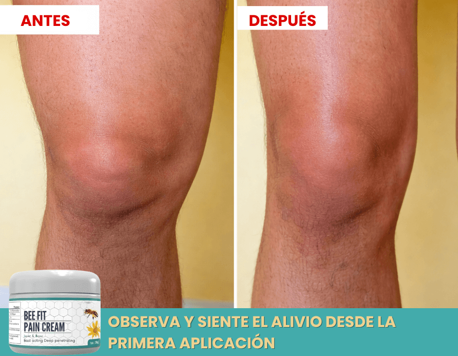 BEE FIT – Alivia el Dolor en Segundos y Repara tus Articulaciones