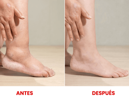 BEE FIT – Alivia el Dolor en Segundos y Repara tus Articulaciones